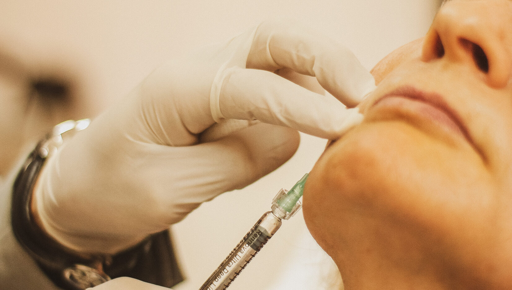 Preenchimento facial: o que é, para que serve, contraindicações e como é feito